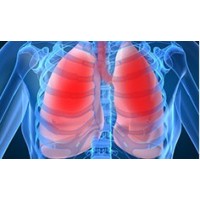 Нервной системы